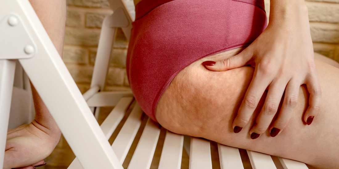 At home ultrasonic cavitation to combat cellulite